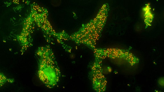 Bei Stress durch hohe Salzkonzentrationen sterben nach einigen Tagen zwar eine Reihe der kultivierten Acinetobacter baumannii-Bakterien ab (orange Punkte), viele leben jedoch in einer Art Tiefschlaf (VNBC, grüne Punkte) weiter. 