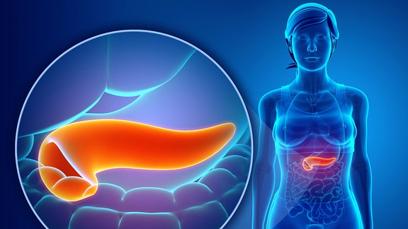 Grafik einer Bauchspeicheldrüse
